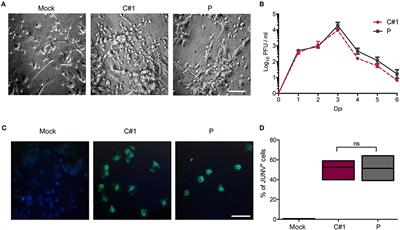 Junin Virus Triggers Macrophage Activation and Modulates Polarization According to Viral Strain Pathogenicity